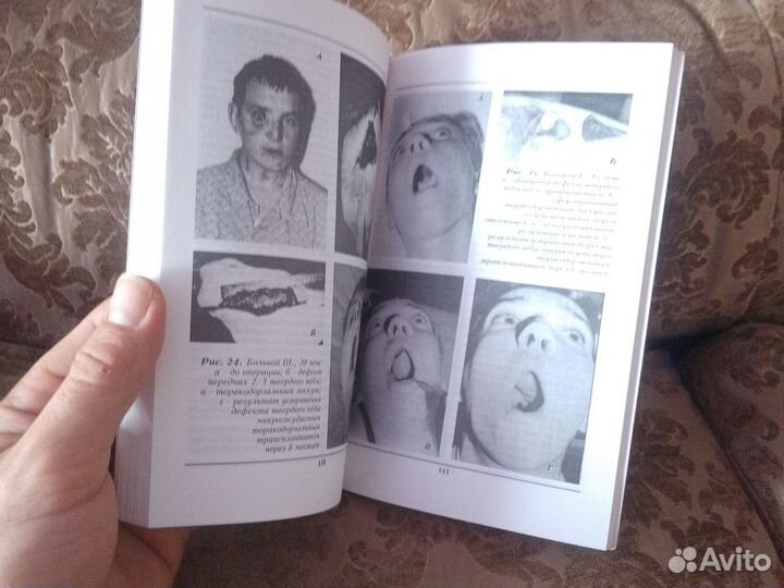 Микрохирургия челюстно-лицевой области