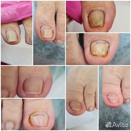 Подология И эстетика