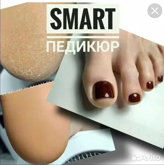 Smart педикюр