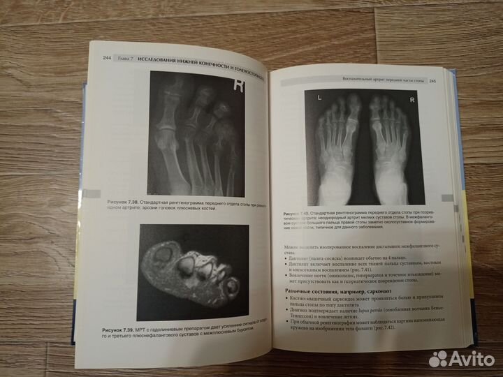 Лучевая диагностика костно-мышечной системы
