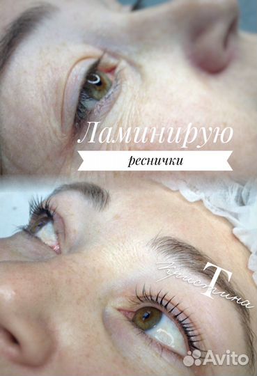 Брови ресницы