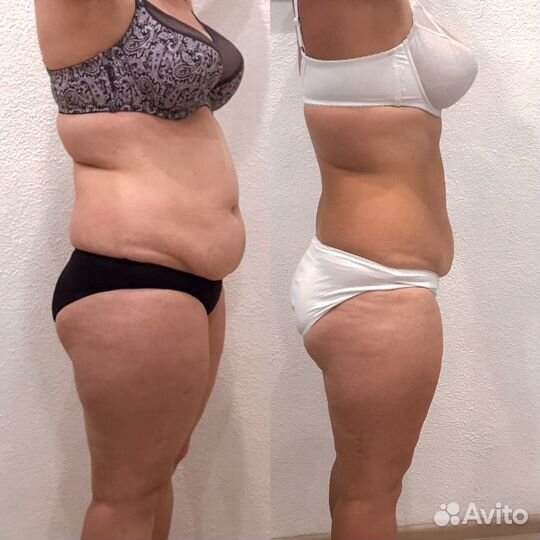 Обертывания для похудения