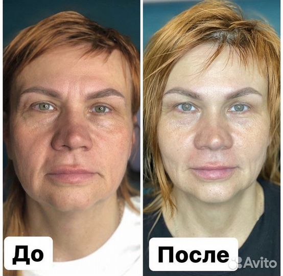 Косметолог - эстетист