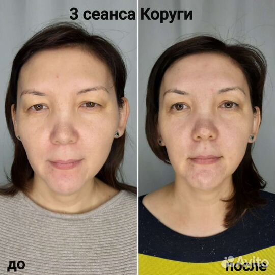 Массаж лица Коруги и массаж тела