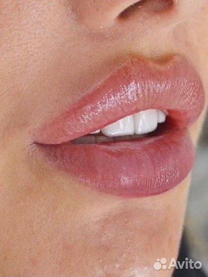 Контурная пластика губ