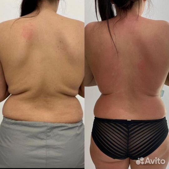 Знакомство с мастером массаж