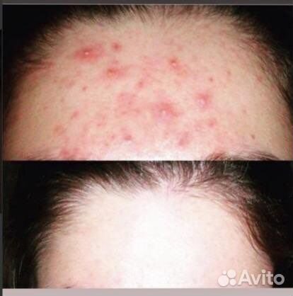 Балтушка для лица