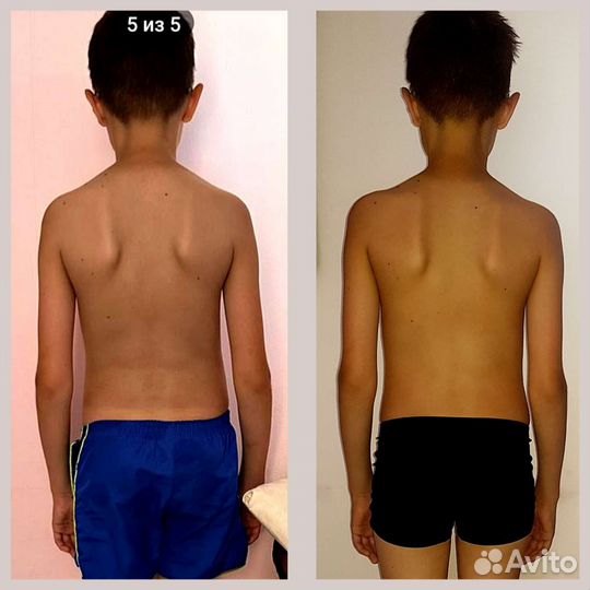 Массаж по триггерным точкам+лфк с мед.образованием