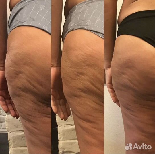 Массаж коррекция фигуры