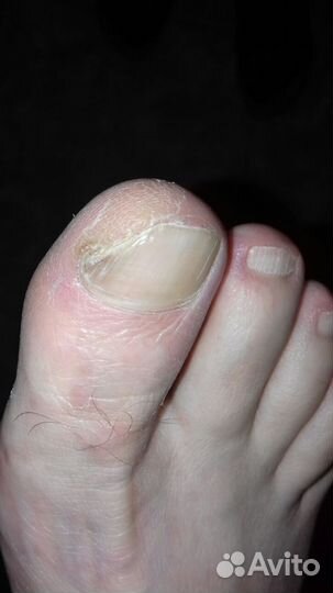 Желудочный сок Гюрзы 10%