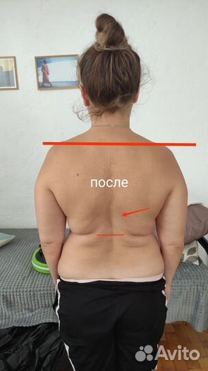 Лечение сколиоза и сопутствующих болезней