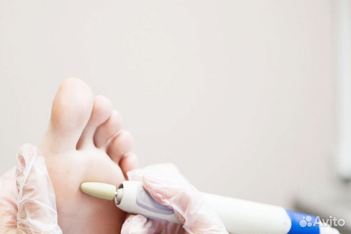 Лечебный педикюр подолог