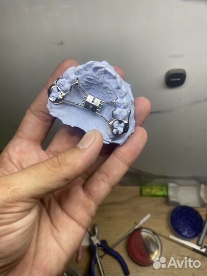 Детские ортодонтические пластинки