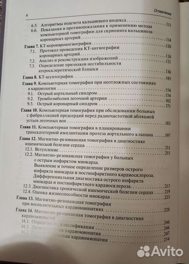 С. К. Терновой Томография сердца