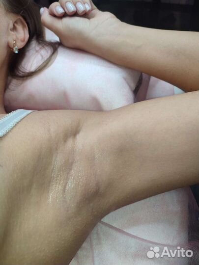 Сахарная депиляция