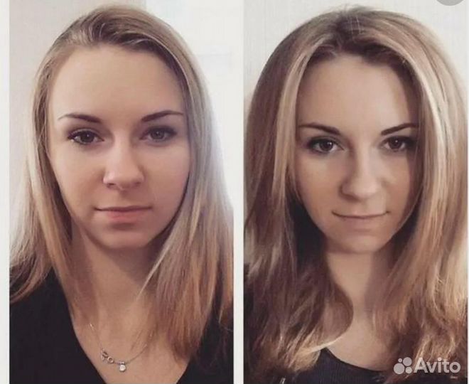 Услуга прикорневой объем