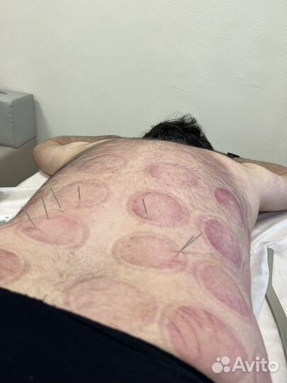 Хрусты. Мануальные техники.Массаж.Обучение