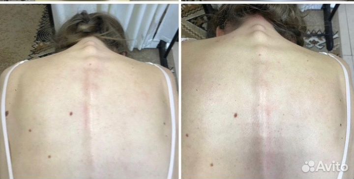 Костоправ, мануальный массаж, мед. образование