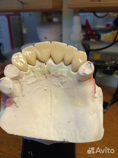Починка протезов, изготовление несъёмных пр-ов