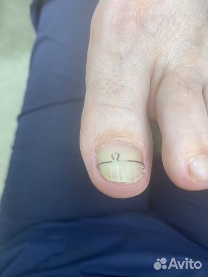 Услуги подолога / педикюр