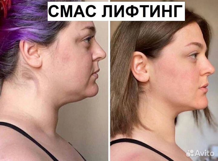 Четкий овал лица