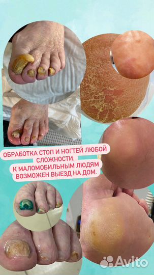 Медицинский и эстетический педикюр и маникюр