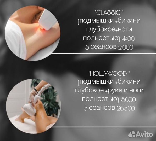 Лазерная эпиляция