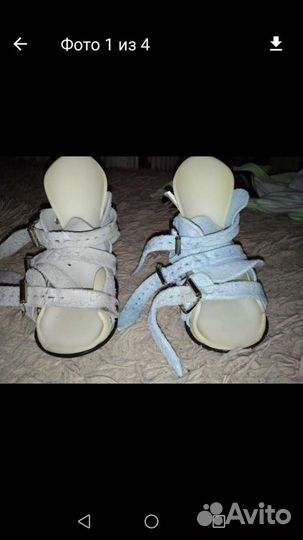 Брейсы Митчелл