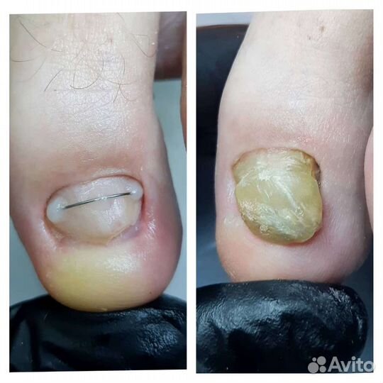 Подолог. Педикюр. Маникюр