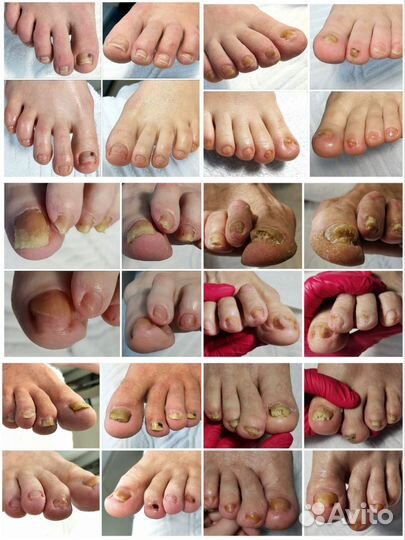 Подолог/Медицинский педикюр и маникюр