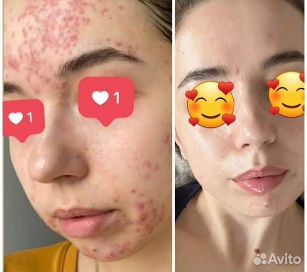 Холодная Плазма