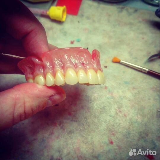 Съёмные протезы, мягкие протезы,зубы