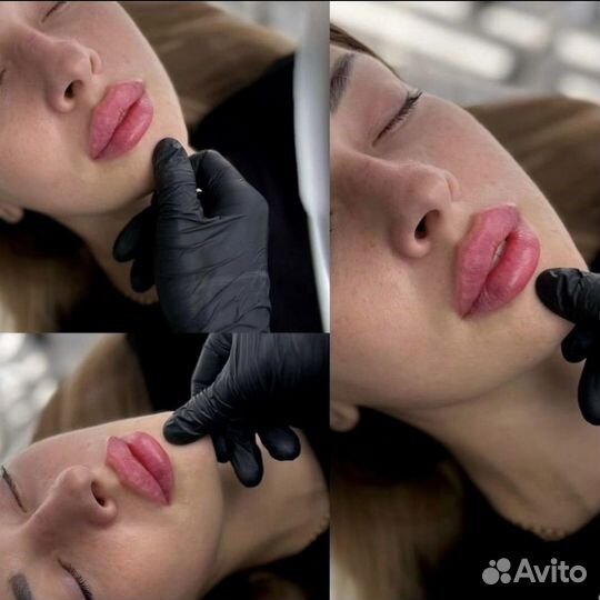 Модель на увеличение губ