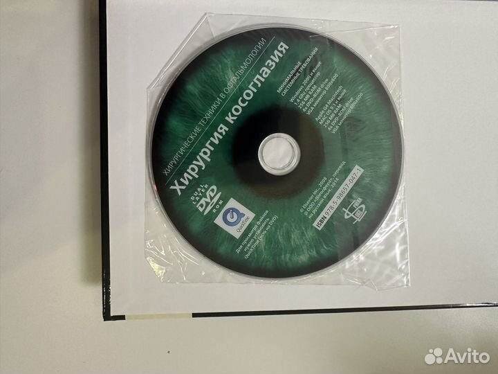 Хирургия косоглазия