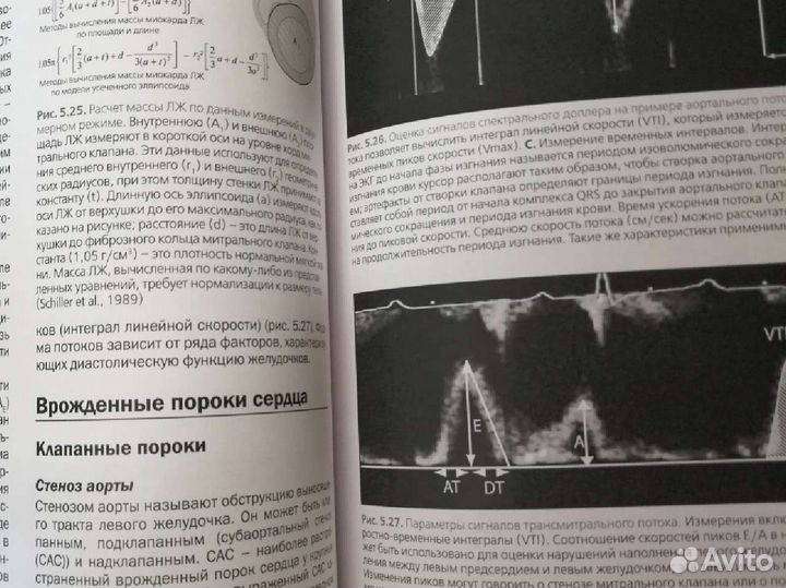 Атлас по ультразвуковой диагностике исследования