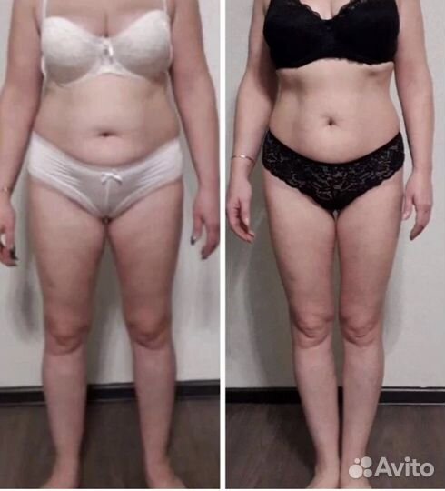 Антицелюлитный массаж