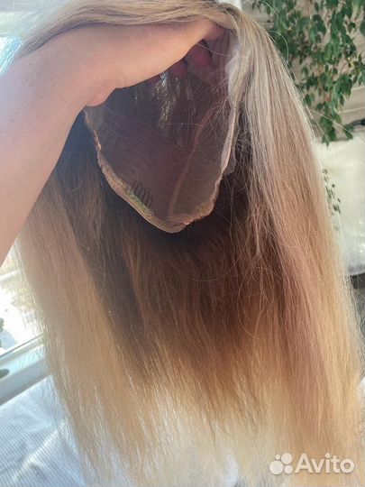 Система замещения волос