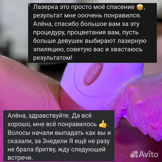 Лазерная эпиляция