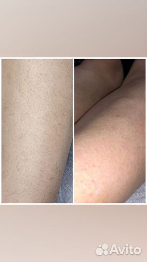 Мастер по депиляции