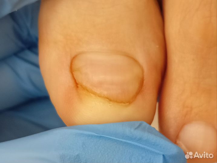 Услуги подолога