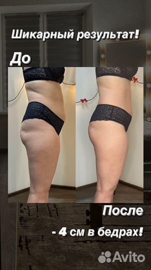 Массаж Кудрово Ручной, аппаратный, обертывания,SPA