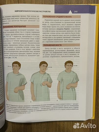 Клиническая неврология Саймон Гринберг