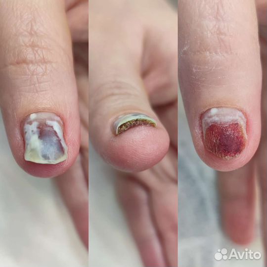 Подолог маникюр педикюр