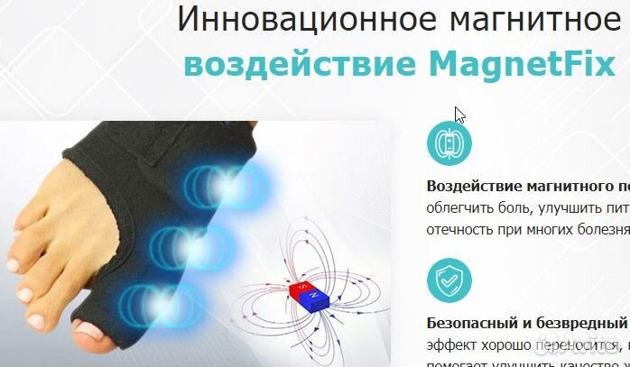 Магнитная вальгусная шина MagnetFix