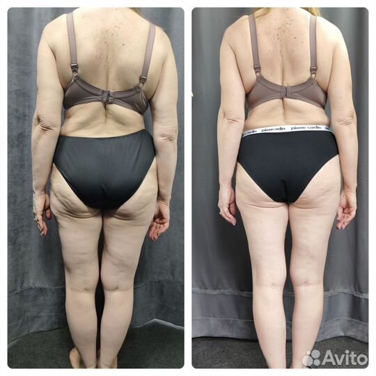 Lpg массаж тело и лицо