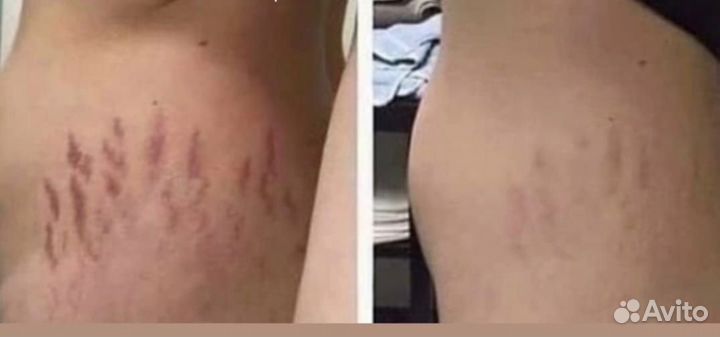 Холодная Плазма