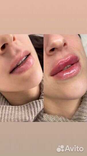 Врач косметолог