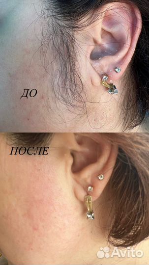 Шугаринг женский