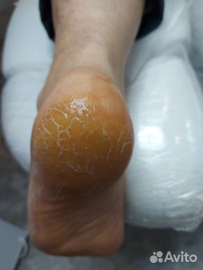 Аппаратный маникюр