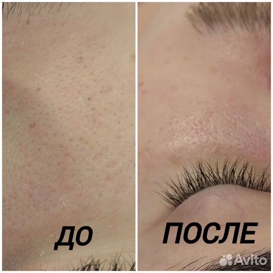 Косметик эстетист